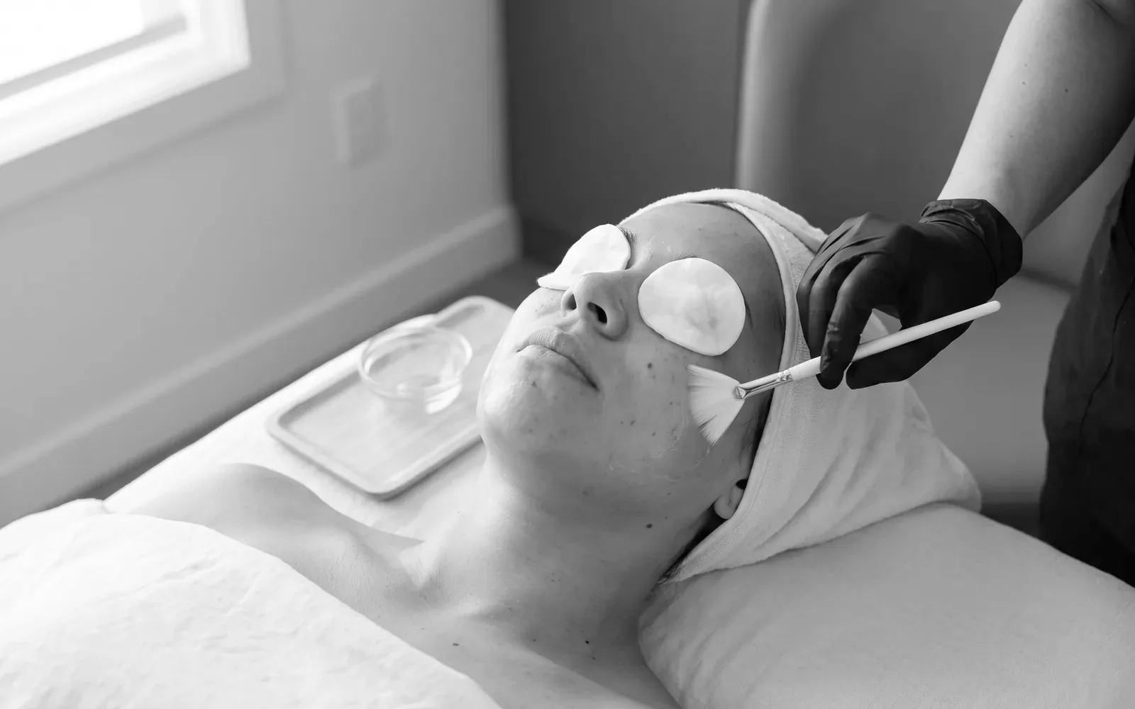 How to Prepare for a Facial Peel: A Gentle Lactic and Glycolic Peel Guide